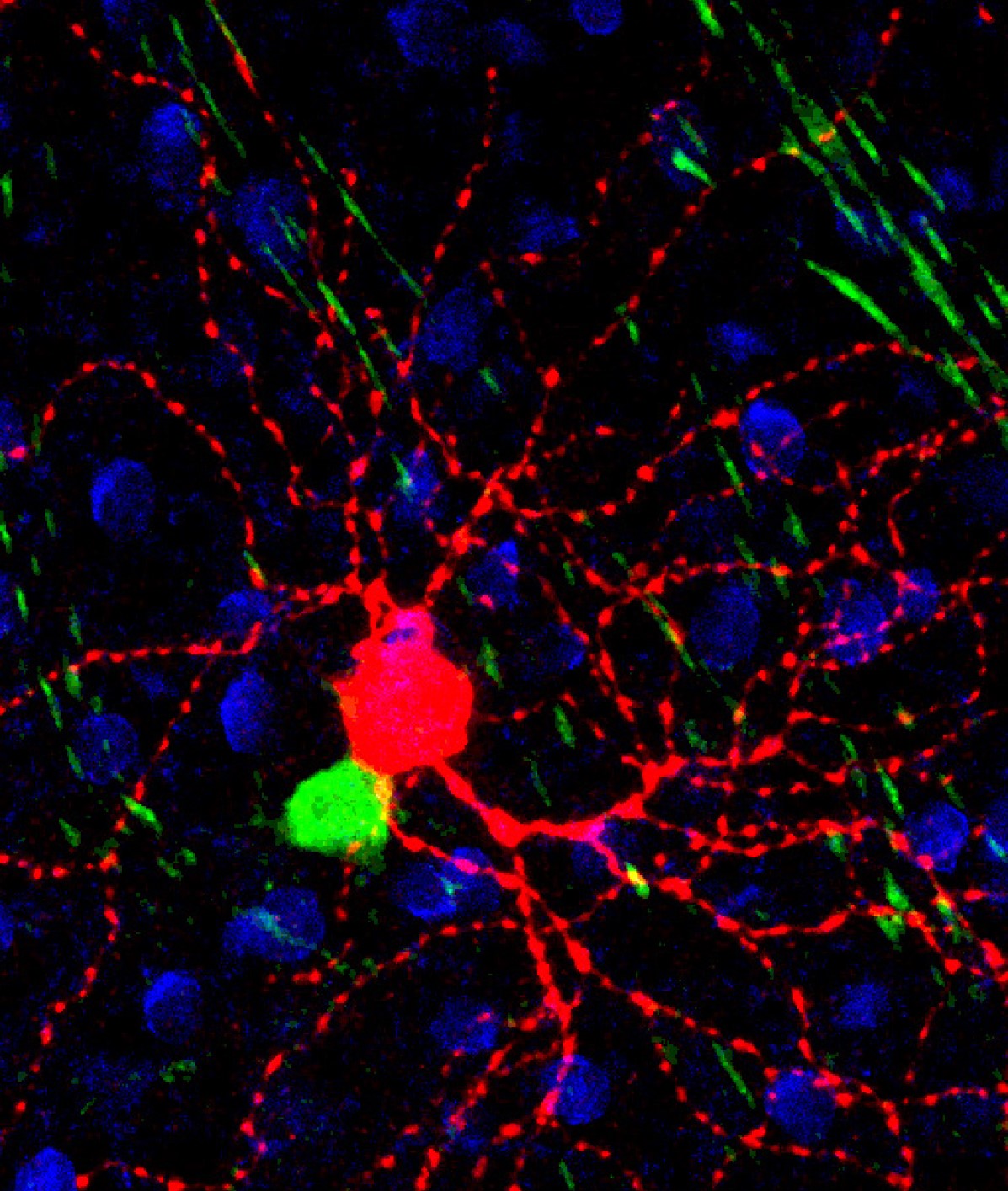 Colorful neurons with cell nuclei in a microscopy image.