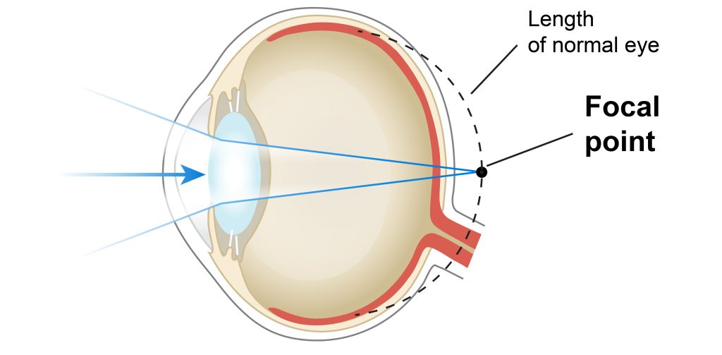 Diagram of human eye anatomy.